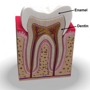 Sensitive teeth Miami FL